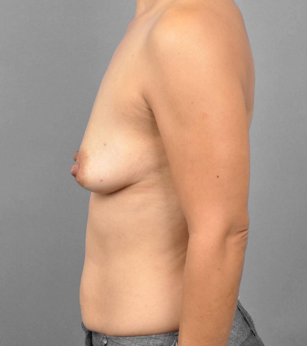 Case 1290 — Oblique before