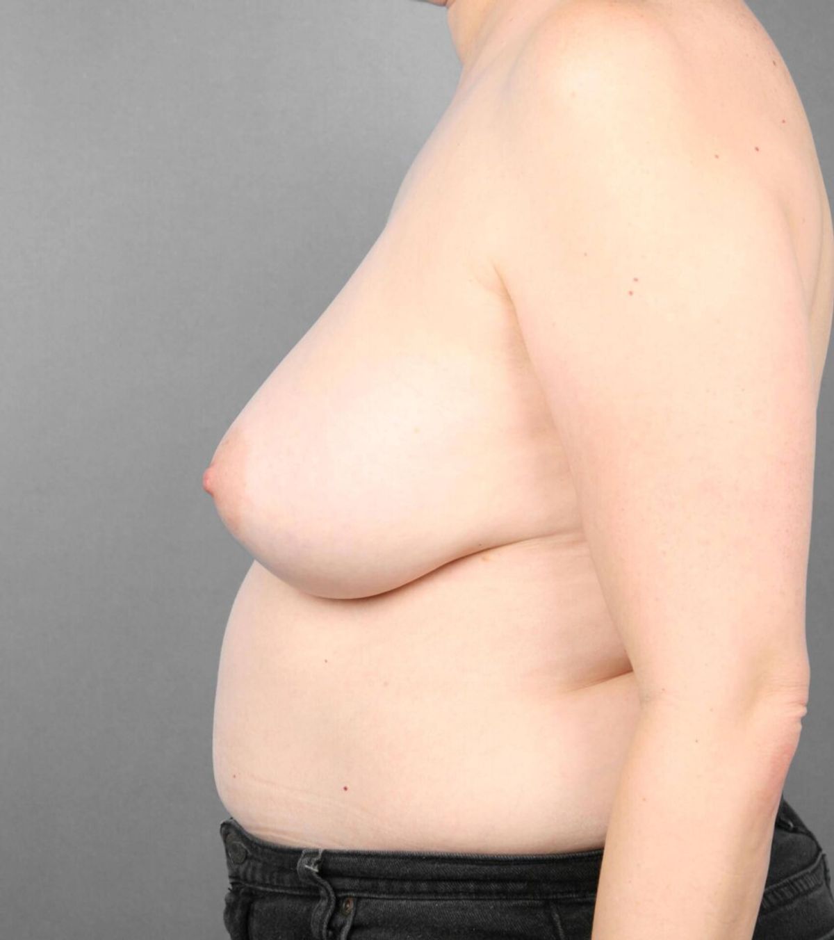Case 1301 — Oblique before