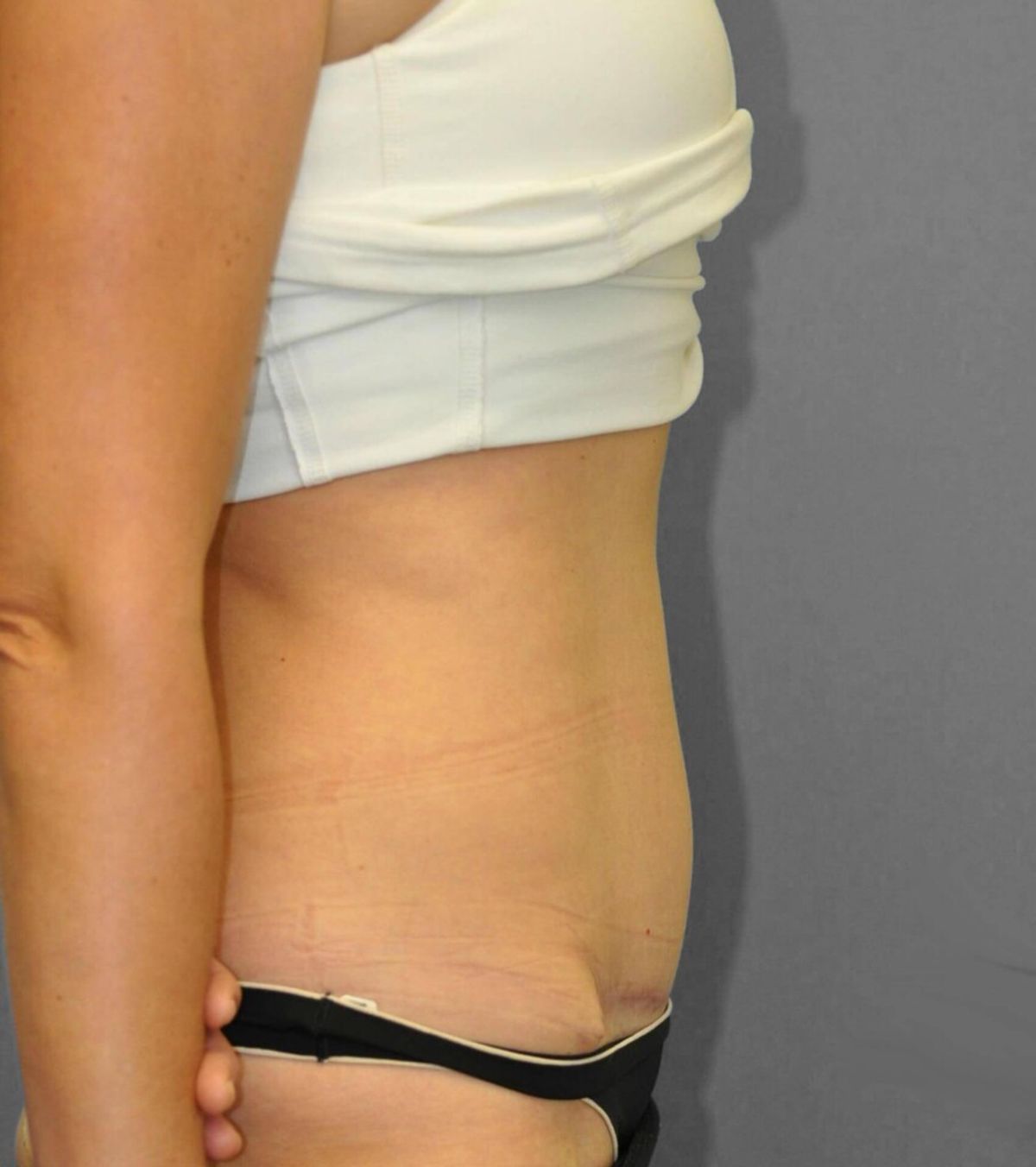 Case 1694 — Oblique after