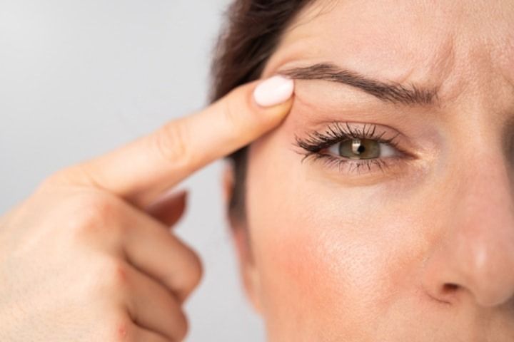 8 Things to Know About Eyelid Surgery Recovery