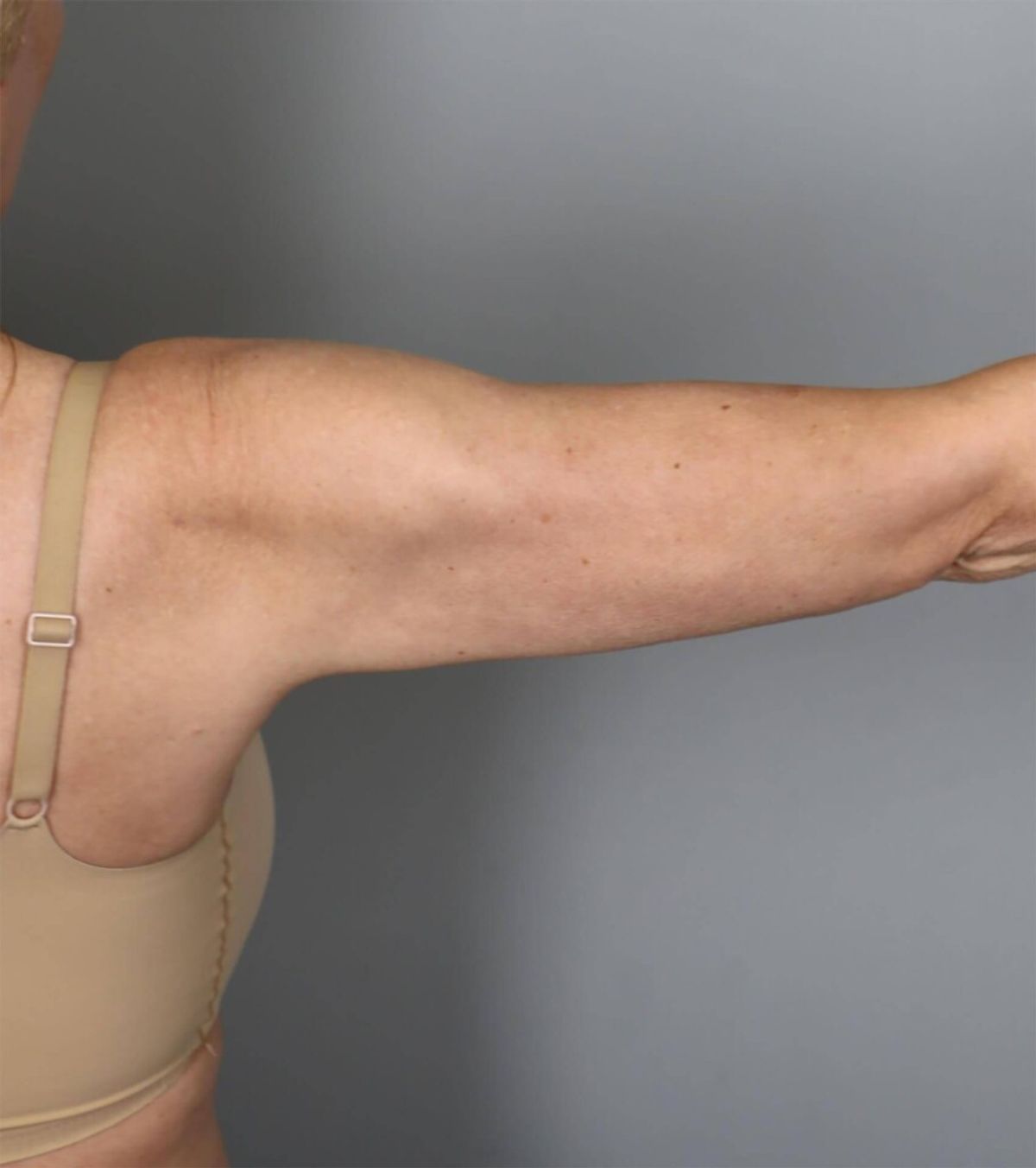 Case 1682 — Oblique after