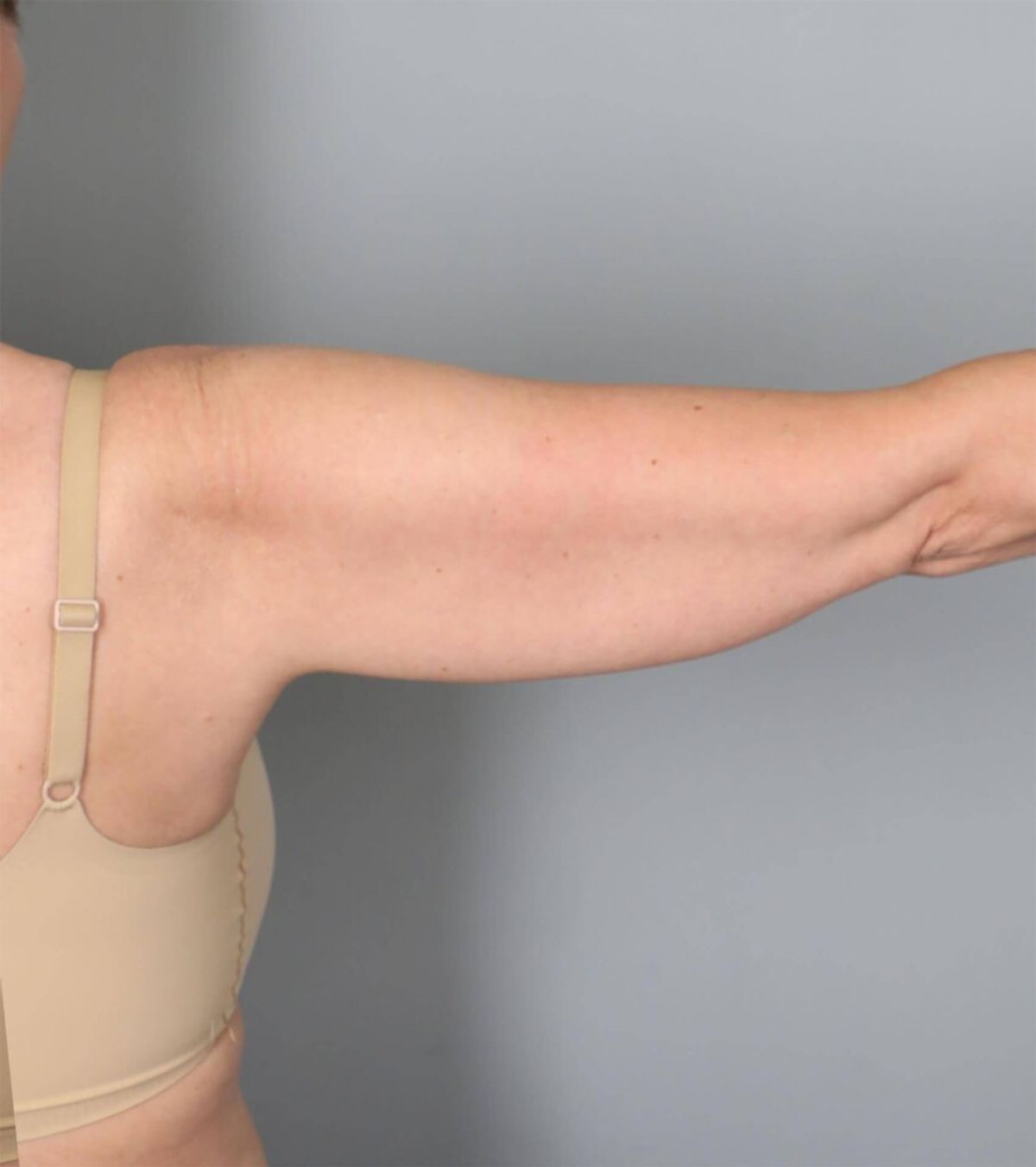 Case 1682 — Oblique before