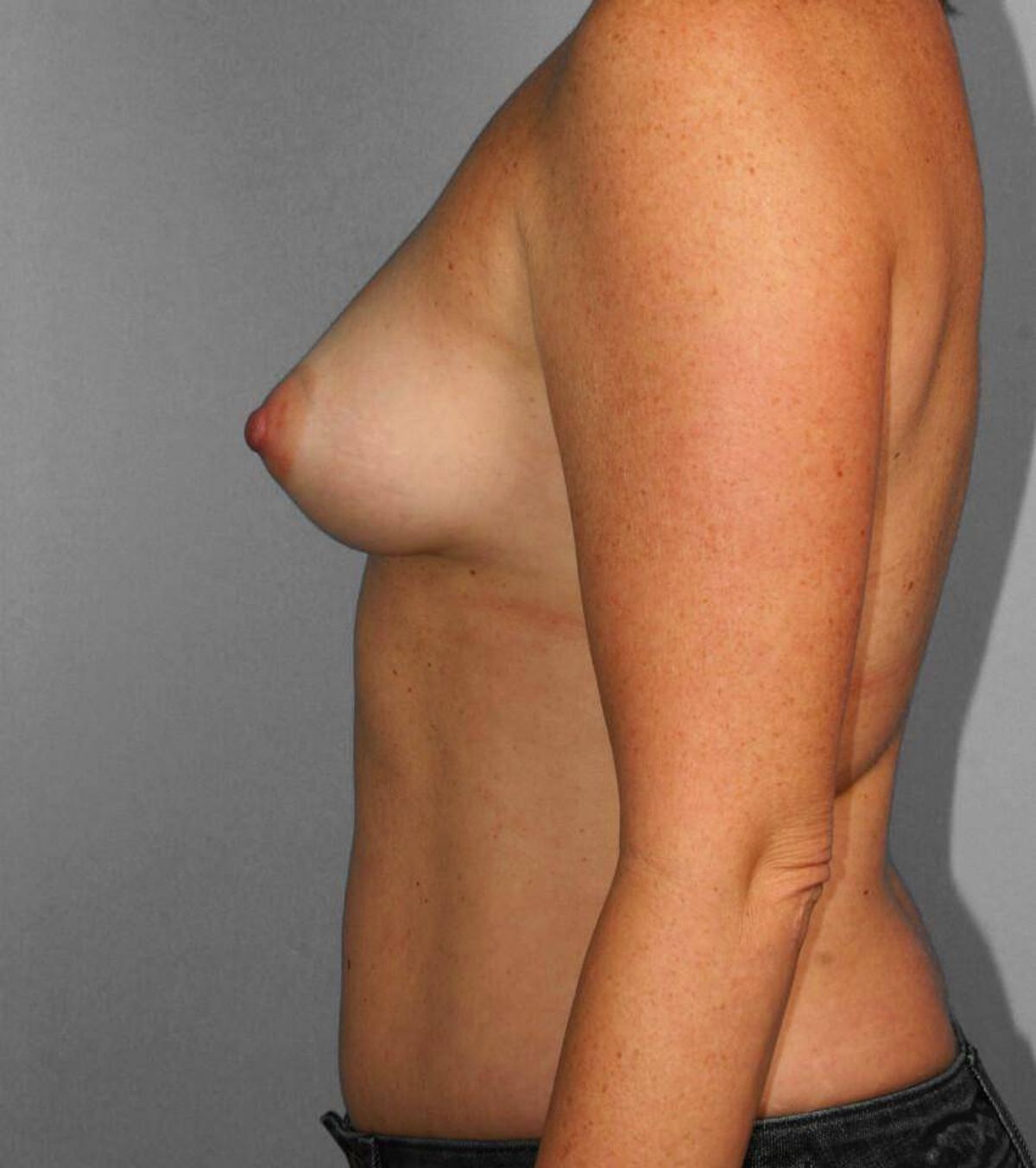 Case 1668 — Oblique before