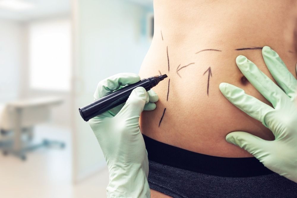 Cosmetic Surgeries Increased During the Pandemic — Here’s Why