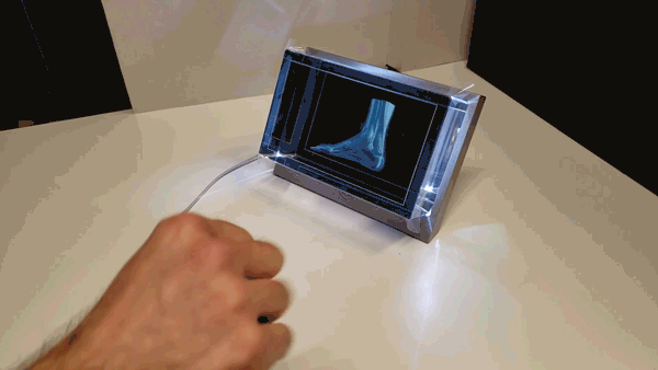 Using a Looking Glass 3D screen, and a Magic Leap sensor in front of it, a person's hand gestures and squeezes while affecting the 3D animated image of muscle in a foot and ankle, causing areas to become red with the squeezing, while rotating in 3D. 