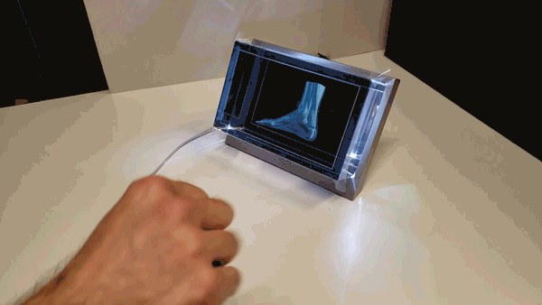 Using a Looking Glass 3D screen, and a Magic Leap sensor in front of it, a person's hand gestures and squeezes while affecting the 3D animated image of muscle in a foot and ankle, causing areas to become red with the squeezing, while rotating in 3D.