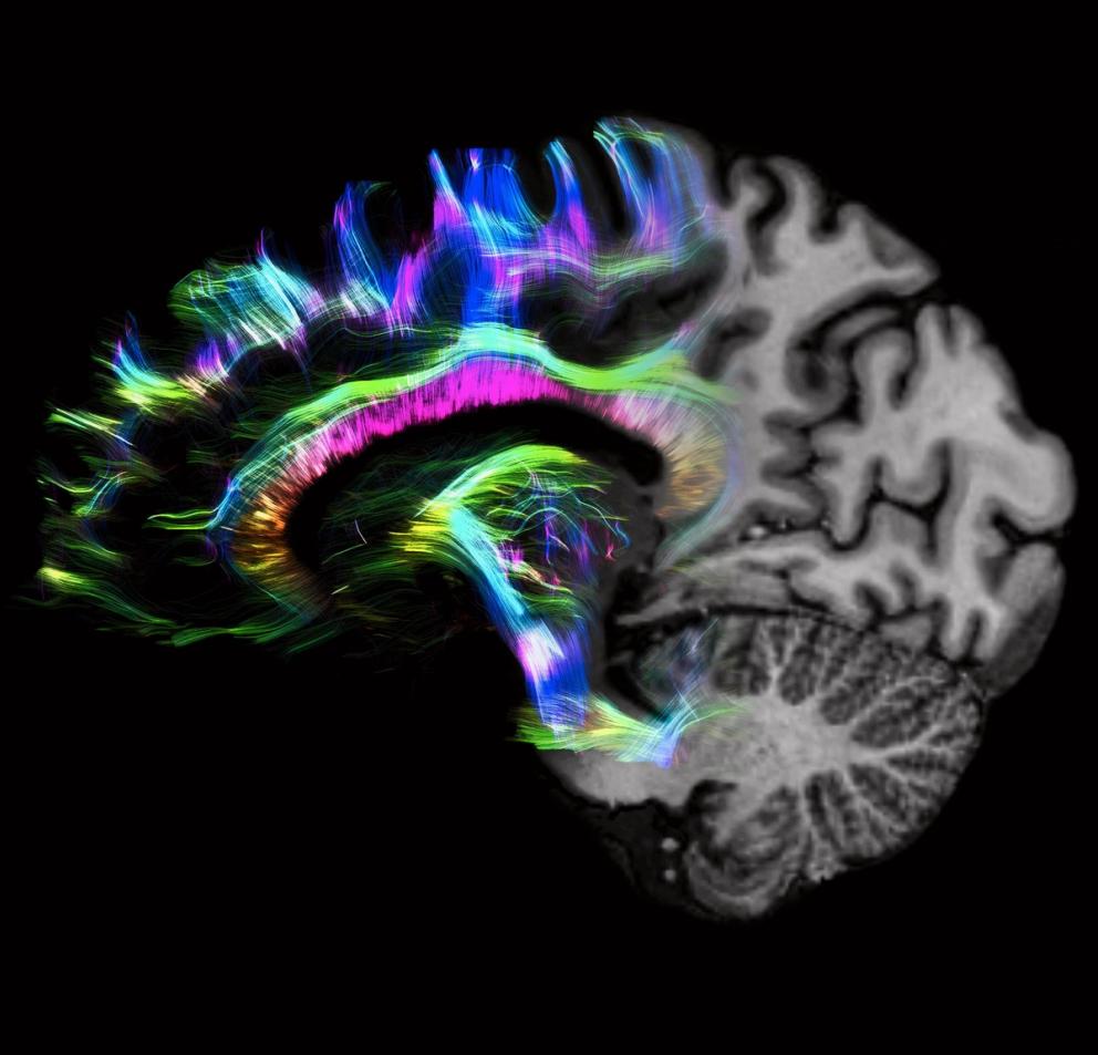 Participant having an MRI scan