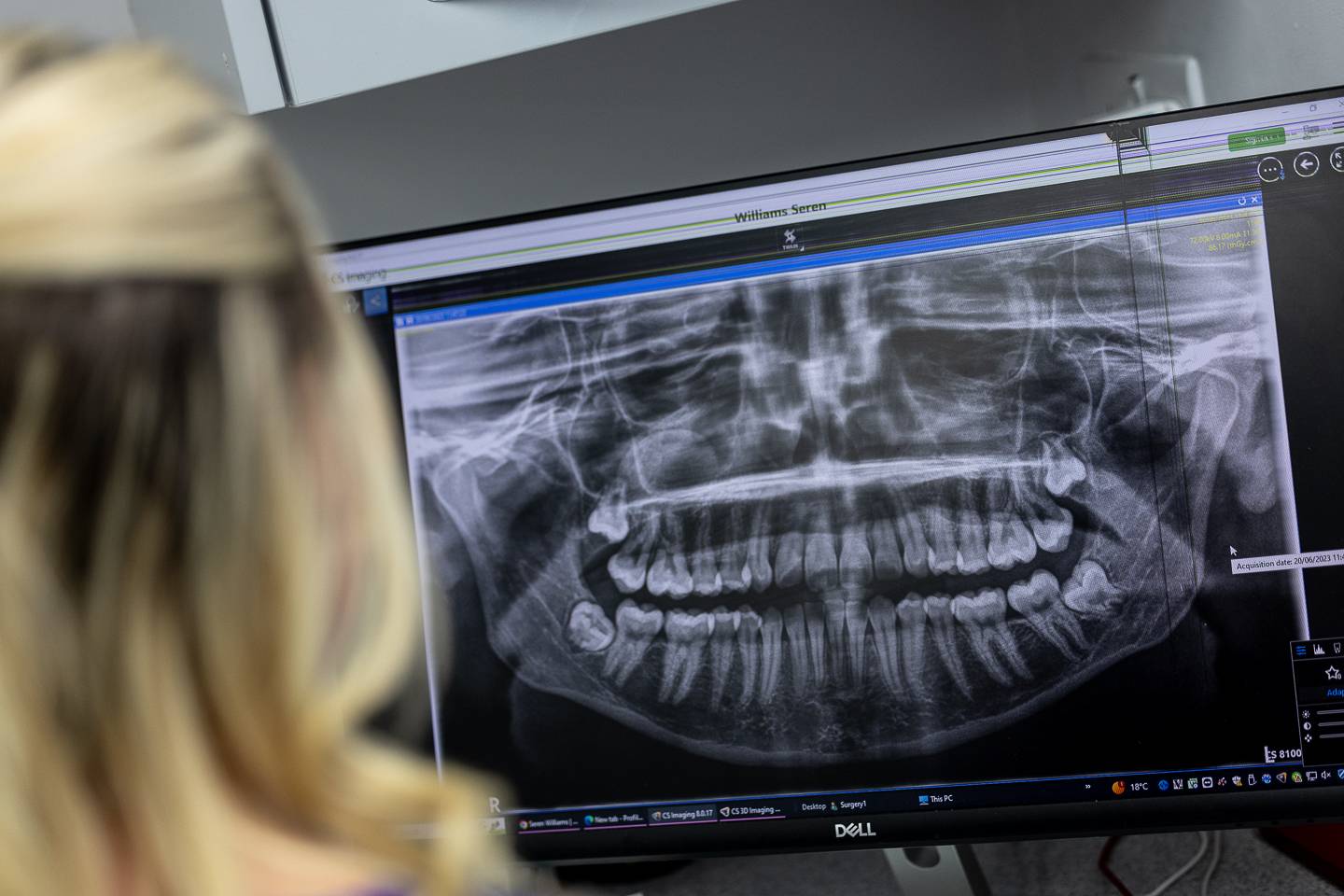 X-ray of patients mouth at Brynteg Dental