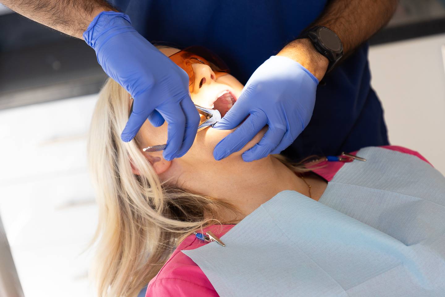 Tooth extraction at Brynteg Dental