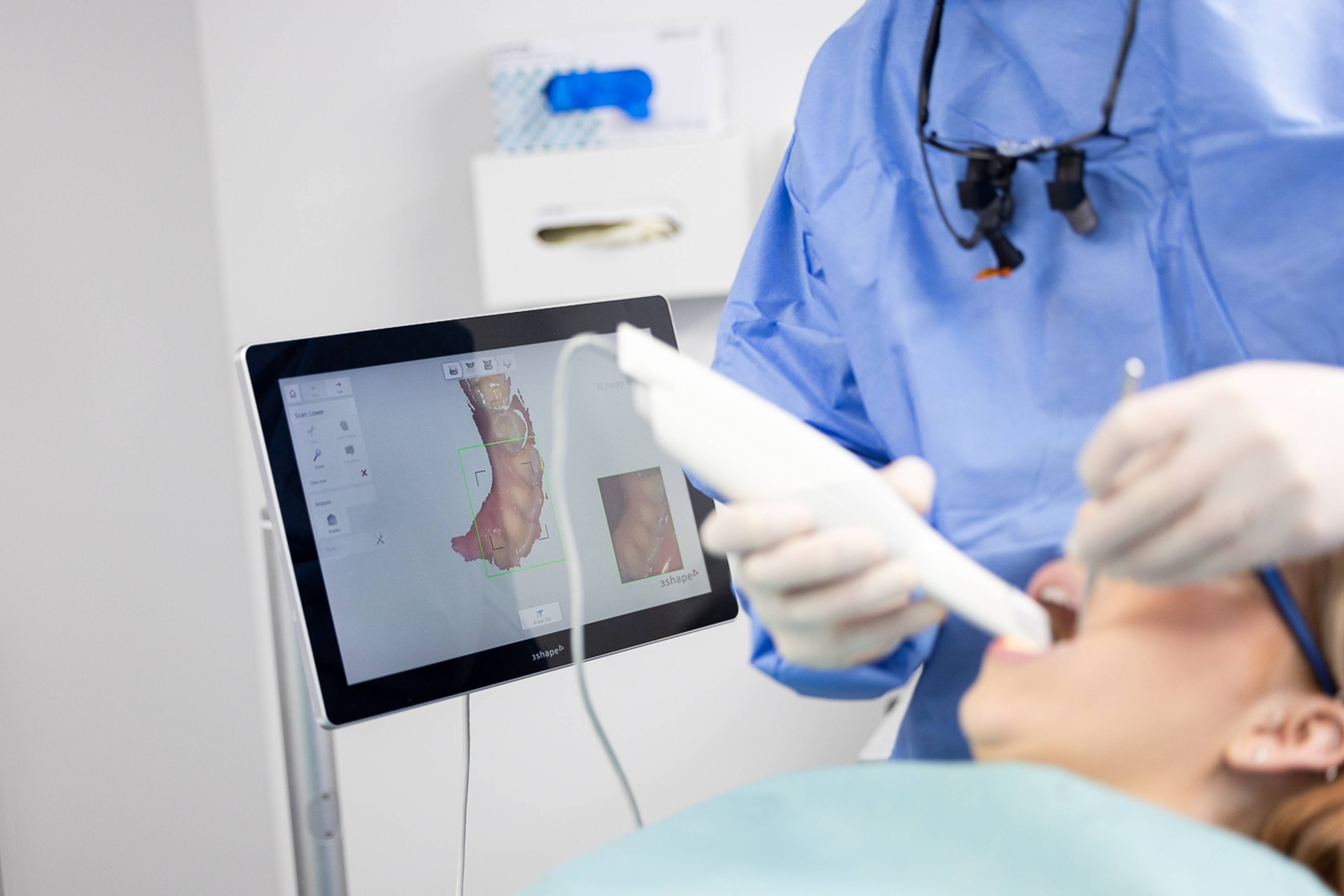 Dental scan for inlay and onlay assessment