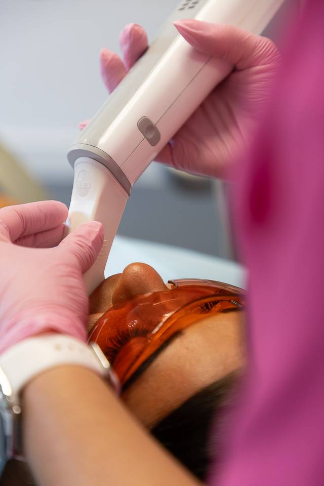 Oral scan at Brynteg Dental