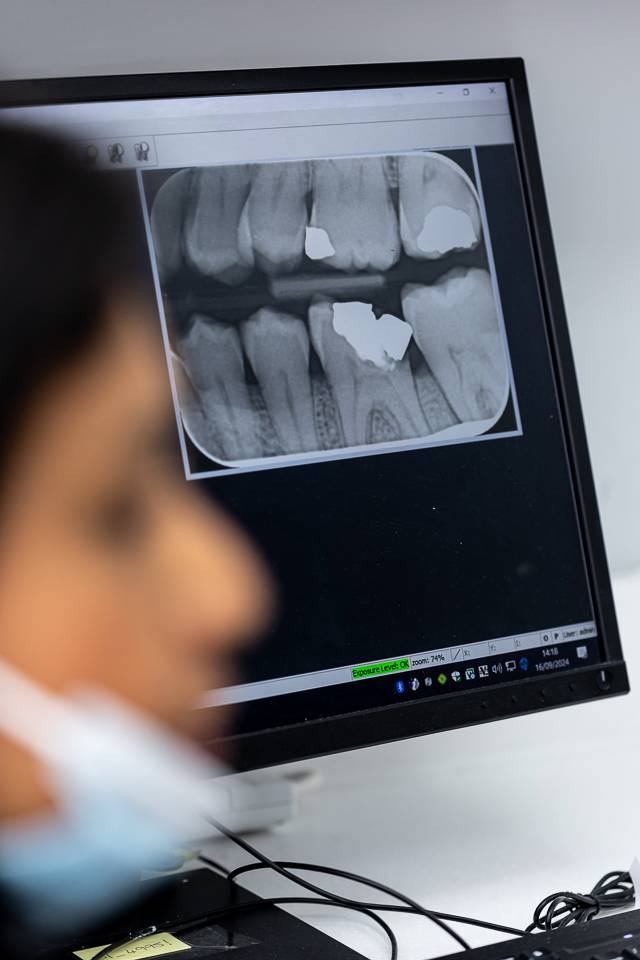 X-ray of patient's teeth