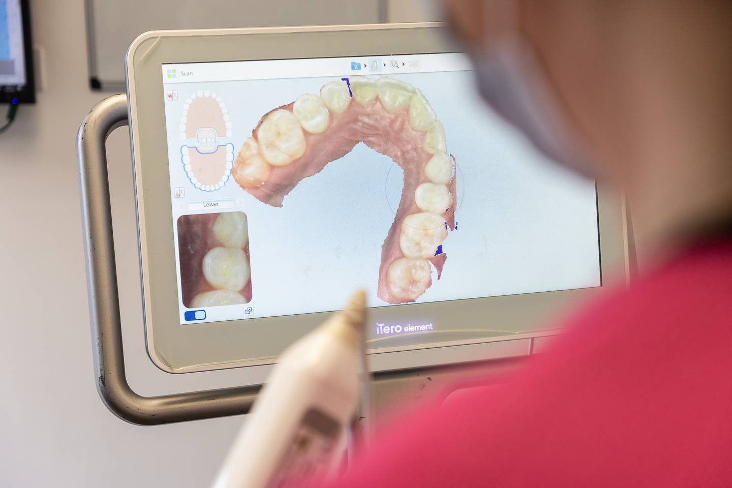 Digital scan of patient's mouth