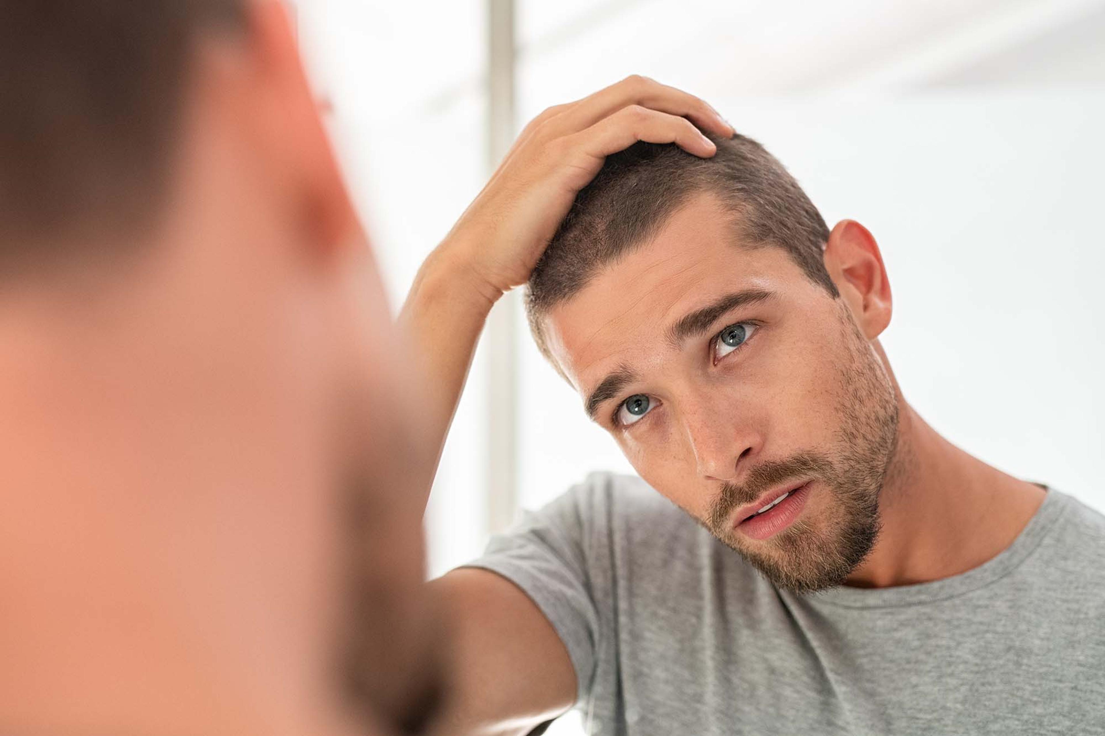 Man examining hair wondering why still losing hair on finasteride.
