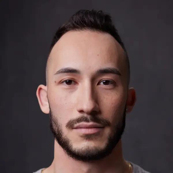 A headshot of a XYON hair loss patient