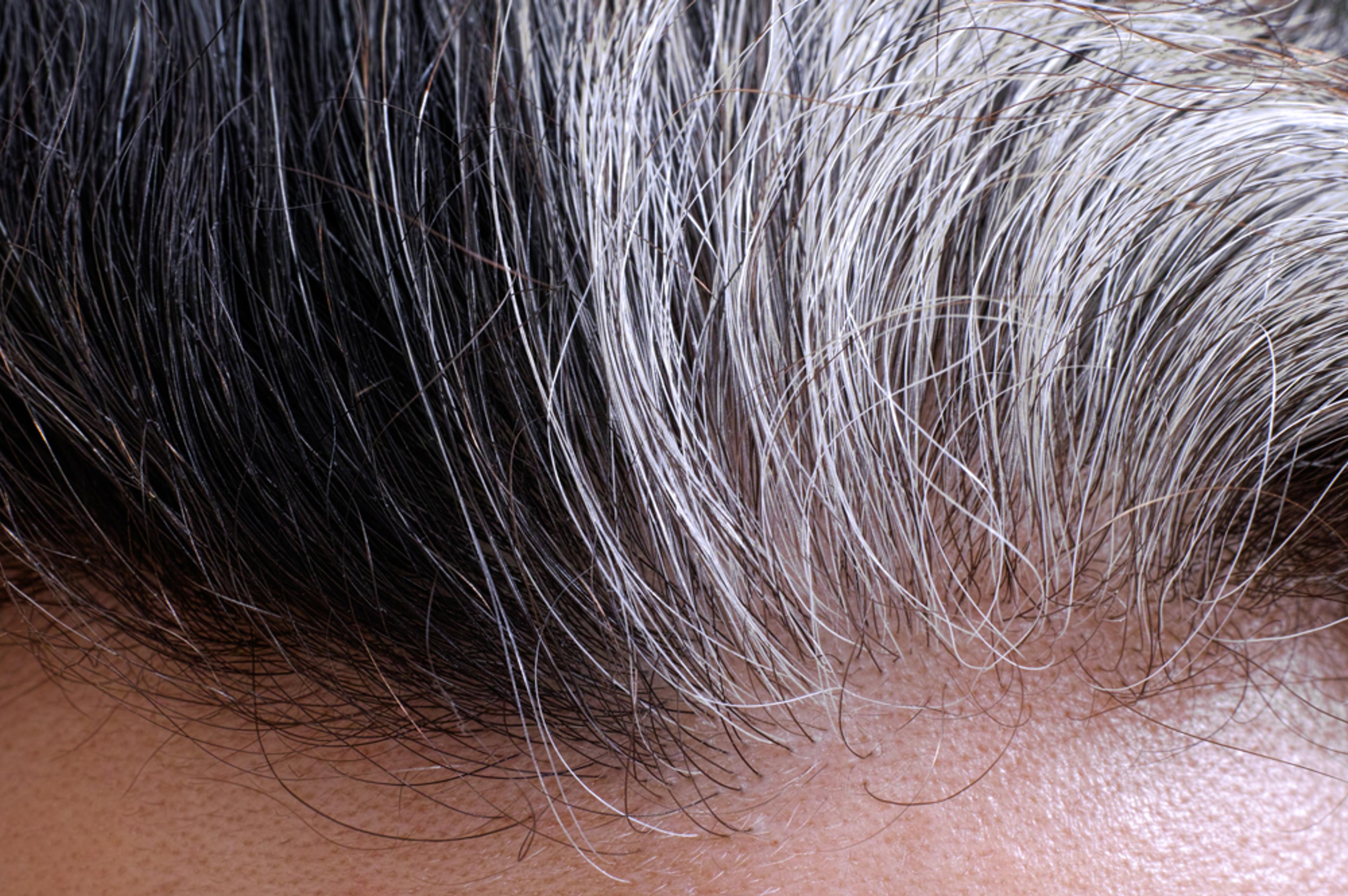 close-up of male scalp anatomy grey hair 
