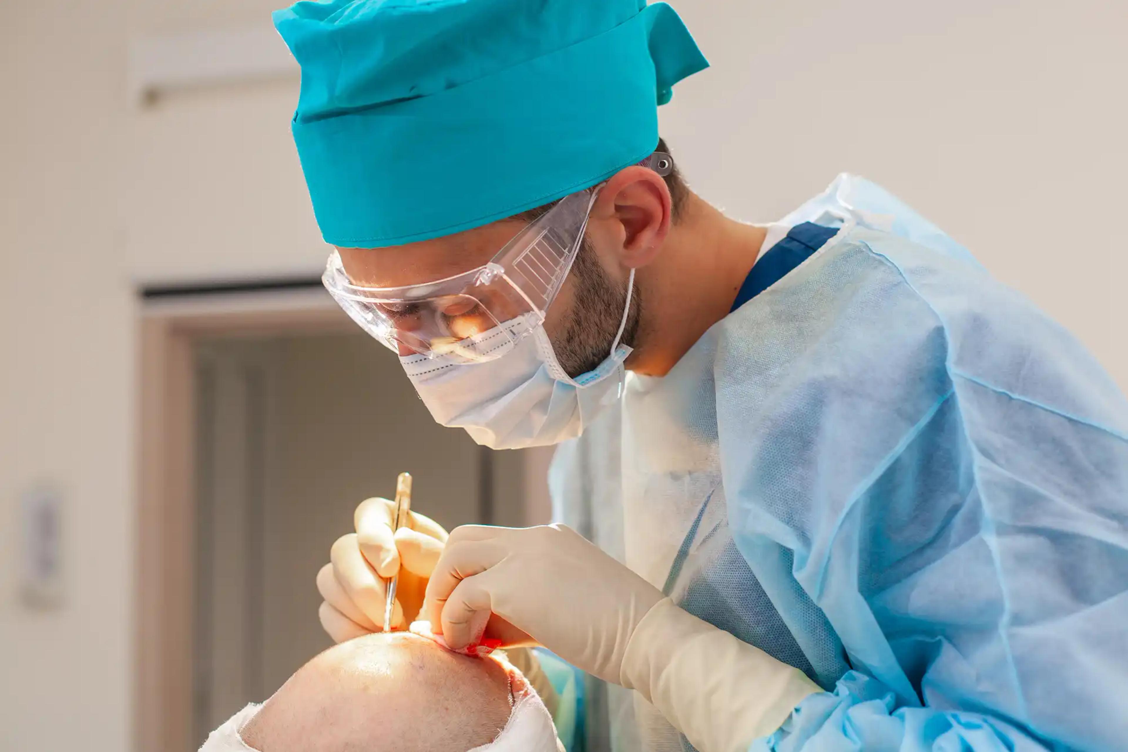 Surgeon performing procedure on patient taking finasteride after hair transplant.