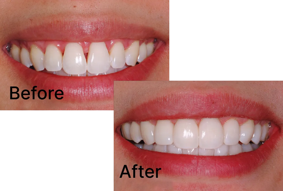 Bioclear case study: Before / After