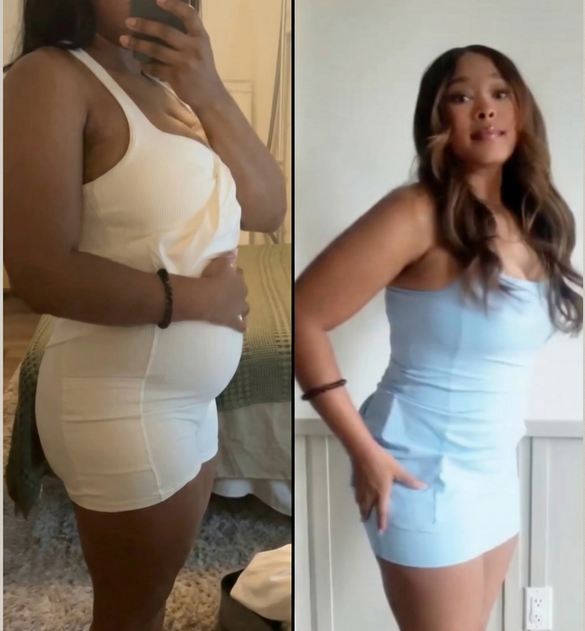 Before and after Flora Biome™ Live Probiotic by Triquetra