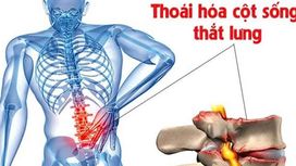 Yoga Trị Liệu Xương Khớp - Hành Trình Khôi Phục Sức Khỏe và Sự Linh Hoạt