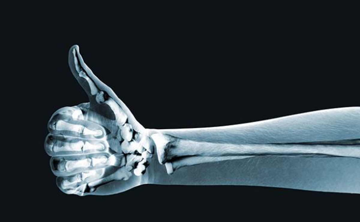 strong bones
