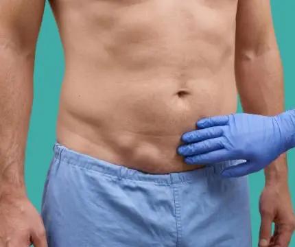 Hernien verstehen. Expertenwissen für Patienten.