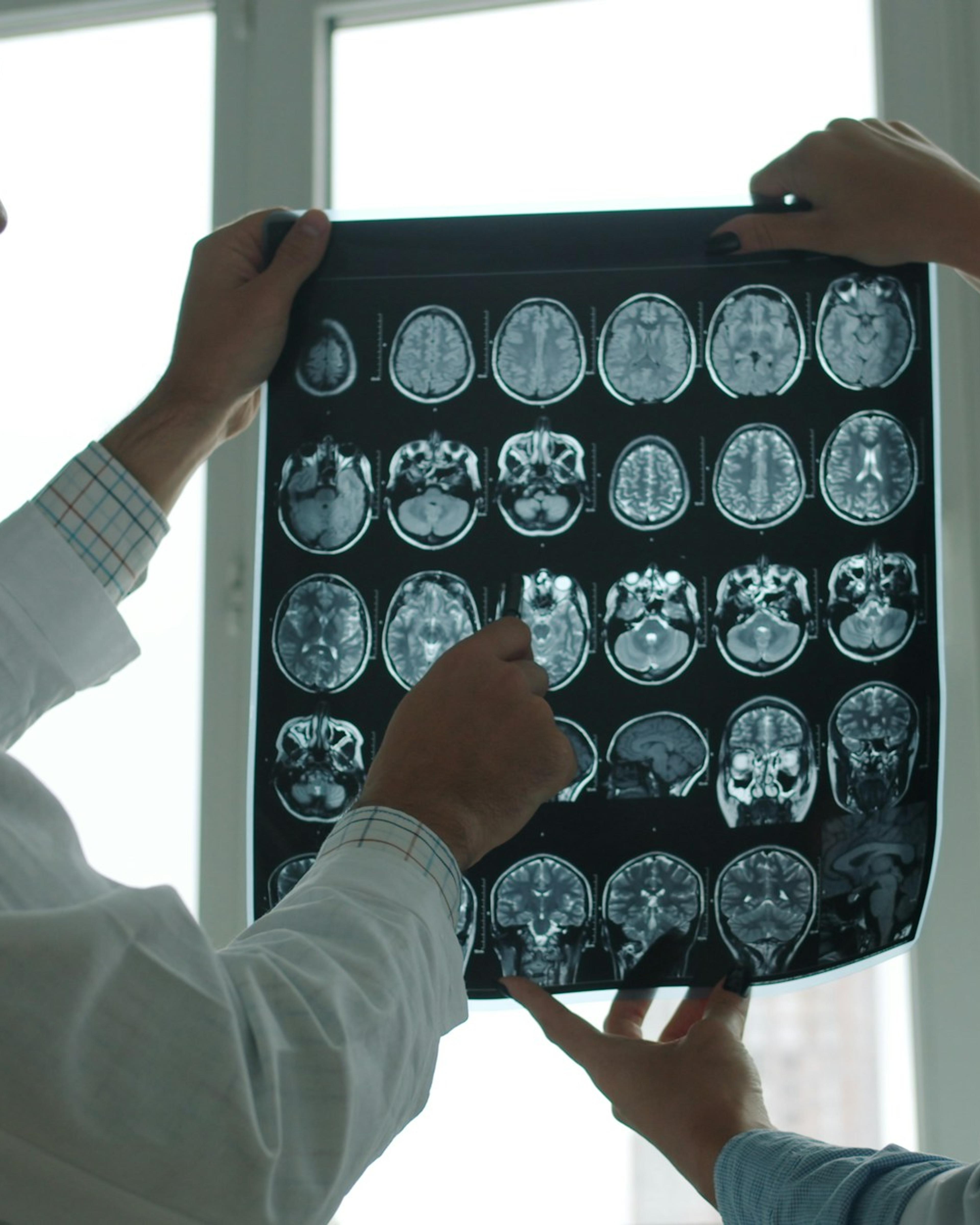 Two doctors reviewing brain MRI images, part of the testing a TBI workers’ comp claim may need
