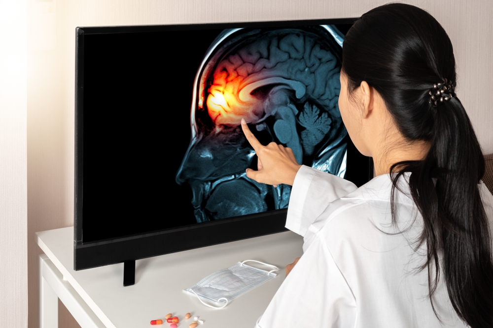 South Plainfield Traumatic Brain Injury Lawyers