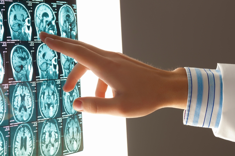 Image Franklin Township Traumatic Brain Injury Lawyers