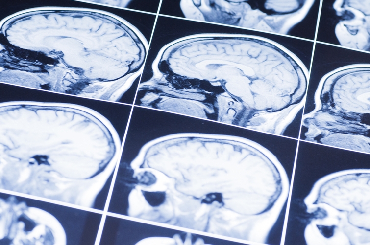 Image South River Traumatic Brain Injury Lawyers