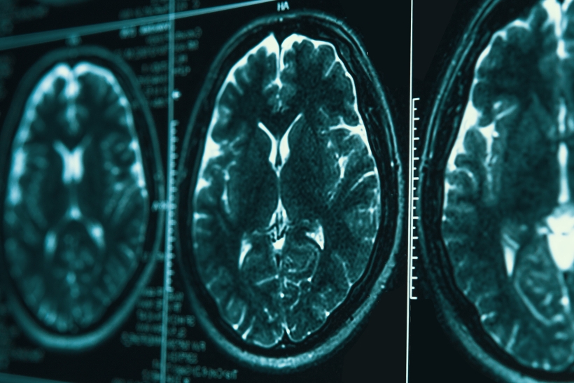 Image New Jersey Traumatic Brain Injury Lawyers