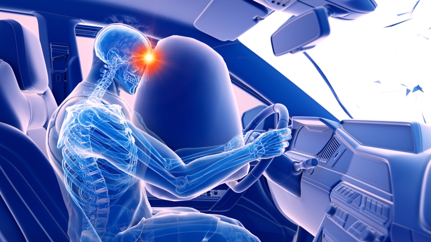 Perth Amboy Traumatic Brain Injury Lawyers