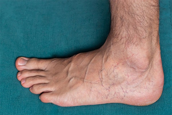 Mans foot with veins