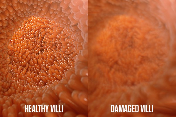 Villi Healthy vs Damaged