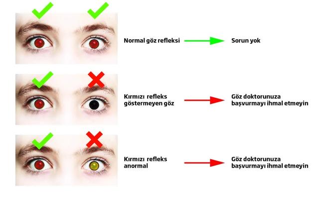 Çocuklarda Göz Sağlığı