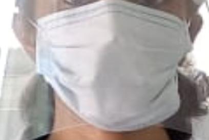 Figure 2 - face mask covering the nose and mouth.