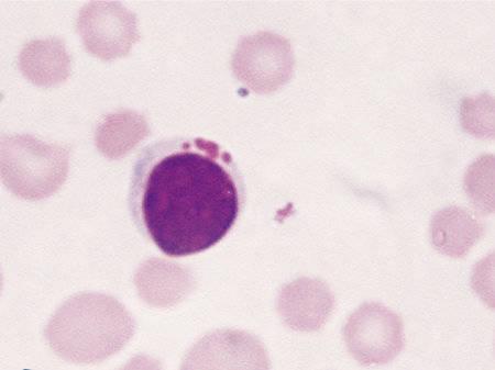 Figure 10 — A large granular lymphocyte with prominent cytoplasmic granules. © BSAVA. Reproduced with permission from the BSAVA Manual of Canine and Feline Clinical Pathology, 3rd edition.
