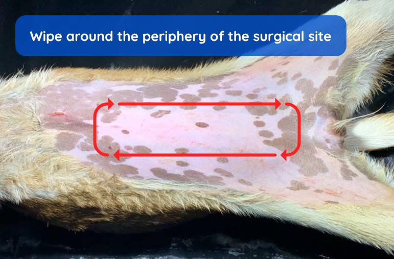 Figure 4 - Wipe around the periphery of the surgical site.