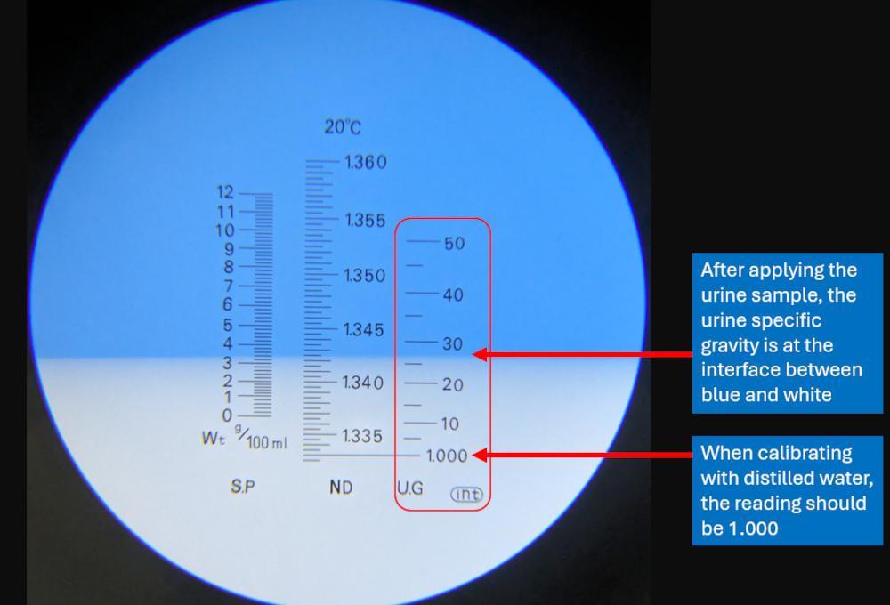 Figure 3. The view through a refractometer, with a urine specific gravity of 1.027.