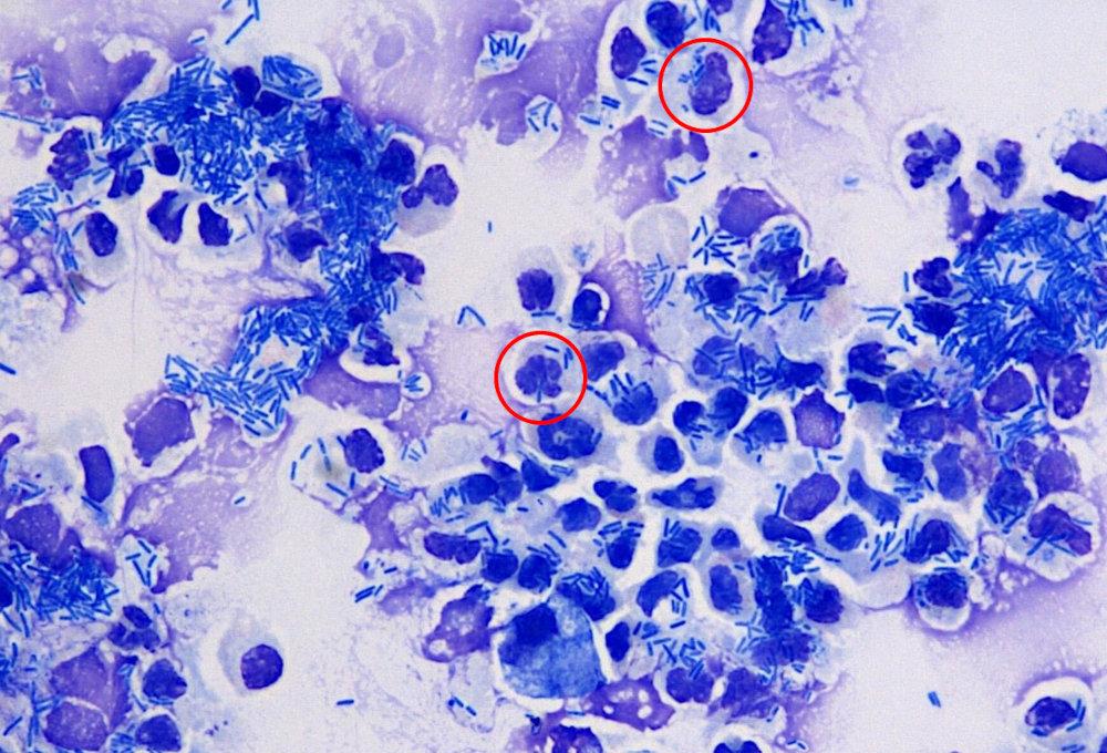 Figure 2. Numerous neutrophils in the urine of a dog with E.coli infection. Note the large number of bacteria, many of which are intra-cytoplasmic (circles). Wrights Giemsa stain, 50x magnification. (Courtesy of Dr Francesco Cian).