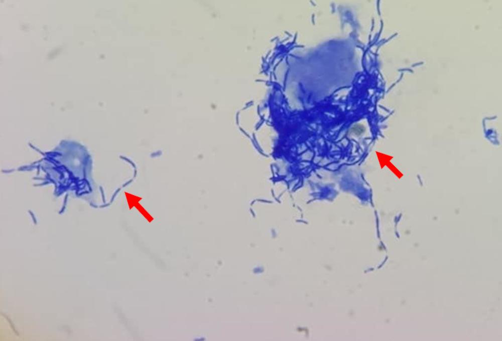 Figure 4. Numerous chains of bacterial rods (arrows) associated with exfoliated epithelial cells in a stained sediment sample from a dog. (Courtesy of Dr An-Ka Sarapata).