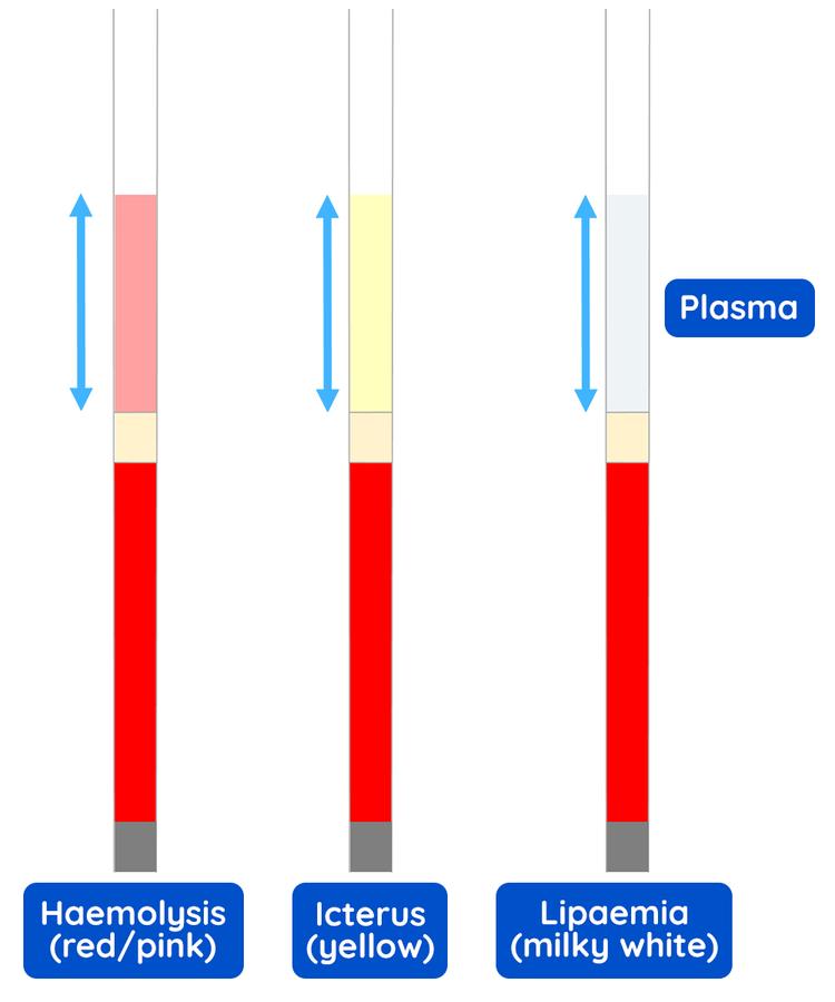 Figure 21