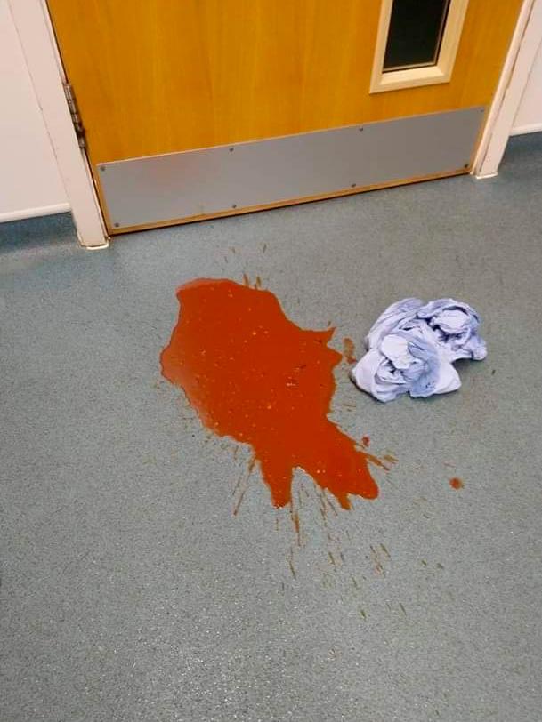 Figure 3 — An example of haemorrhagic diarrhoea, typically seen in dogs with parvoviral infection