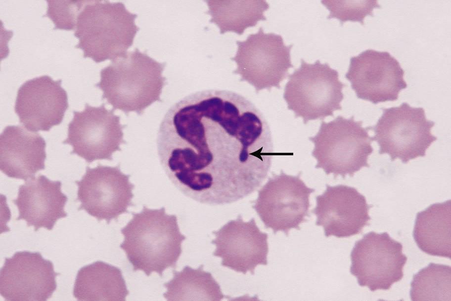 Figure 1 — A canine neutrophil. The arrow shows the Barr body, a remnant of an X-chromosome in female animals. © BSAVA. Reproduced with permission from the BSAVA Manual of Canine and Feline Clinical Pathology, 3rd edition.