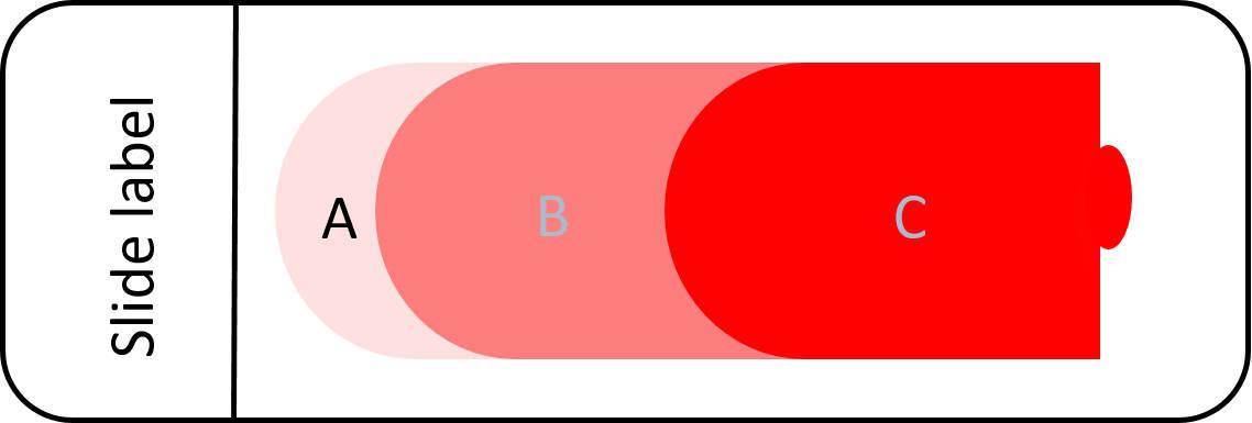 Figure 2 — Feathered edge (A)