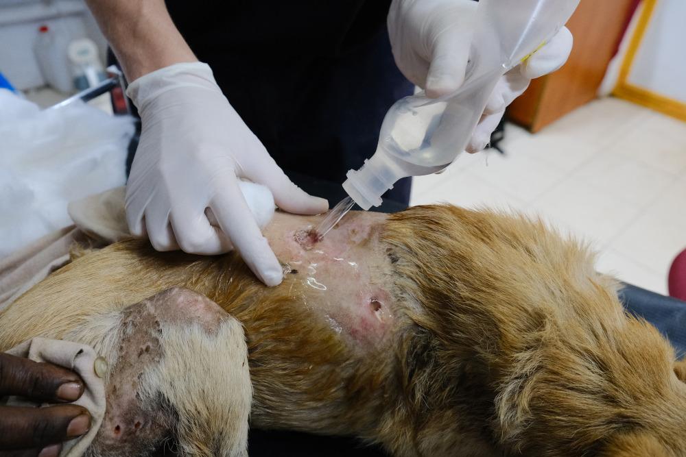 Figure 3 - Clinician performs wound lavage, directly from a saline bottle.