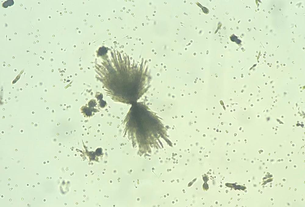 Figure 14. Calcium phosphate crystals forming a rosette type pattern. (Courtesy of Dr Sree Varsha)