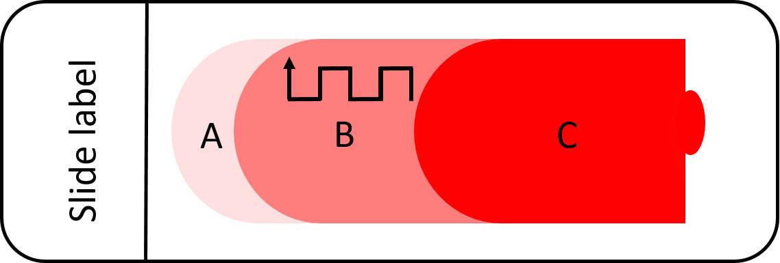 Figure 5 — The 'battle meander' method for differential white cell counts in the monolayer (B)