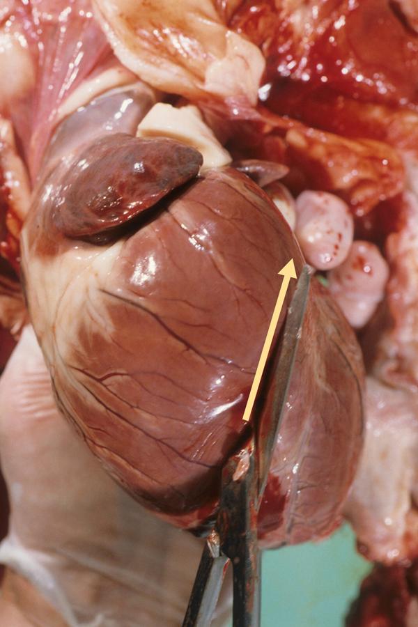 an image of heart dissection