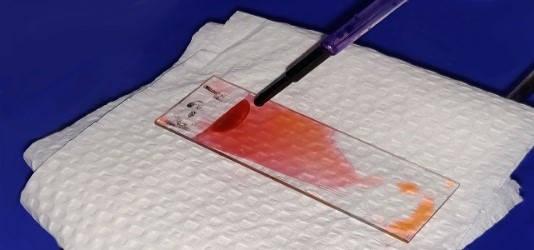 Figure 6 — Application of Fields stain A